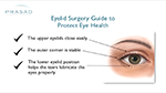 eyelid health diagram and checklist