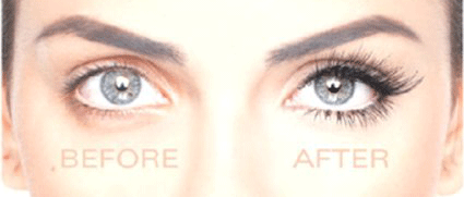 before and after Eyelash Transplant female model