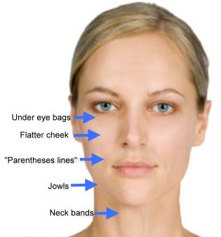 eye lift plus facial aging treatment areas