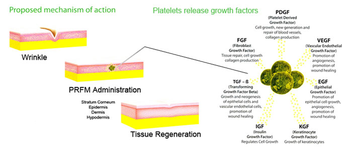 how Selphyl® Plasma corrects wrinkles illustration