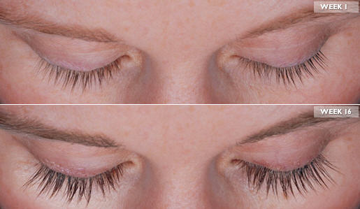 Latisse Eyelash Growth 1 week after treatment and 16 weeks after treatment