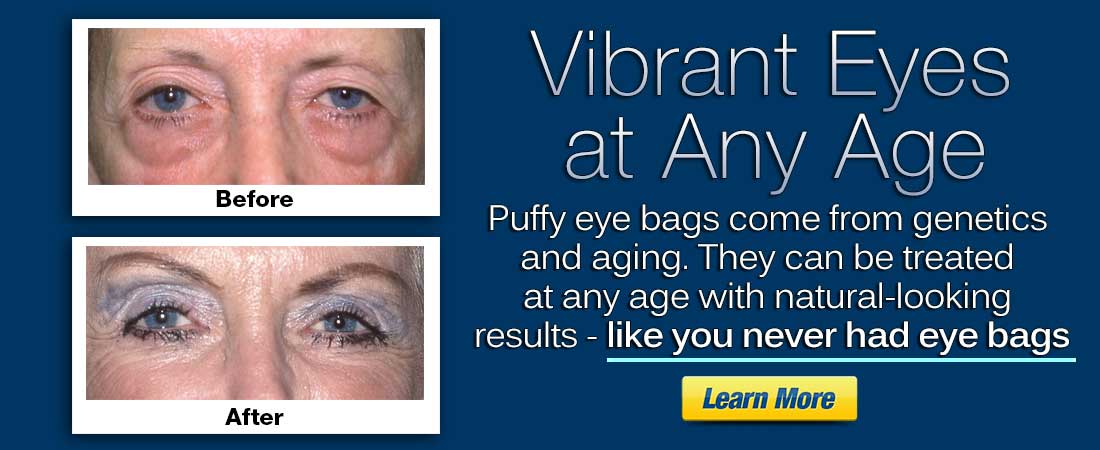 click here to view  before and after puffy eye bags surgery gallery