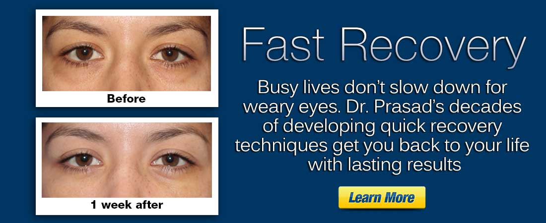 click here to learn how to quickly recover after eyelid surgery